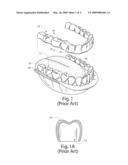 Method for Repositioning Teeth diagram and image