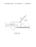 WIRE BOND ENCAPSULANT APPLICATION CONTROL diagram and image