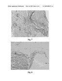 ACTIVE PEPTIDE OF BONE MORPHOGENETIC PROTEIN-2, METHOD FOR MANUFACTURING THE SAME AND THE APPLICATION diagram and image