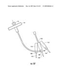 MAGNETIC TARGETING SYSTEM FOR FACILITATING NAVIGATION diagram and image