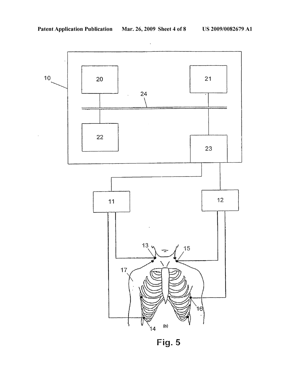 CARDIAC MONITORING SYSTEM - diagram, schematic, and image 05