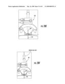 CONTROL UNIT FOR MRI-GUIDED MEDICAL INTERVENTIONAL SYSTEMS diagram and image