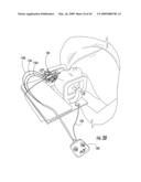 CONTROL UNIT FOR MRI-GUIDED MEDICAL INTERVENTIONAL SYSTEMS diagram and image