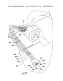 CONTROL UNIT FOR MRI-GUIDED MEDICAL INTERVENTIONAL SYSTEMS diagram and image