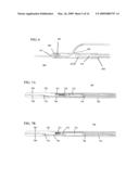 DEVICES AND METHODS FOR REMOTE SUTURE MANAGEMENT diagram and image