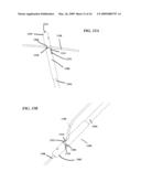 DEVICES AND METHODS FOR REMOTE SUTURE MANAGEMENT diagram and image