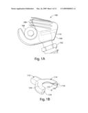 Provisional locking pedicle screw system and method diagram and image