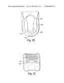 Provisional locking pedicle screw system and method diagram and image