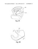 Provisional locking pedicle screw system and method diagram and image