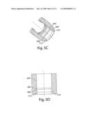 Provisional locking pedicle screw system and method diagram and image