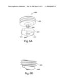 Provisional locking pedicle screw system and method diagram and image