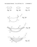 Transpedicular, Extrapedicular and Transcorporeal Approaches to the Intervertebral Discs diagram and image