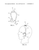 Vestibular Stimulation System diagram and image