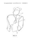 Vestibular Stimulation System diagram and image