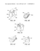 Apparatus and Methods For Charging An Implanted Medical Device Power Source diagram and image