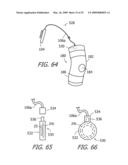 Apparatus and Methods For Charging An Implanted Medical Device Power Source diagram and image