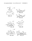 Apparatus and Methods For Charging An Implanted Medical Device Power Source diagram and image