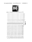 Systems and Methods for Controlling and Billing Neuro-EEG Synchronization Therapy diagram and image