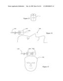 Systems and Methods for Controlling and Billing Neuro-EEG Synchronization Therapy diagram and image