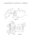 Systems and Methods for Controlling and Billing Neuro-EEG Synchronization Therapy diagram and image