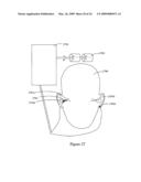 Systems and Methods for Controlling and Billing Neuro-EEG Synchronization Therapy diagram and image