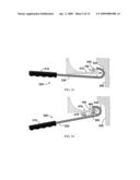 Apparatus and Method for Securing Uvula diagram and image