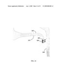 Apparatus and Method for Securing Uvula diagram and image