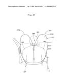 Airbag for front passenger  seat diagram and image