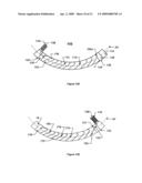 Conductor Assembly Including A Flared Aperture Region diagram and image