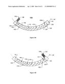 Conductor Assembly Having An Axial Field In Combination With High Quality Main Transverse Field diagram and image