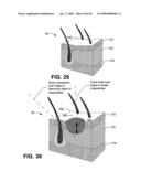 Portable aspects for x-ray fluorescence visualizer, imager, or information provider diagram and image