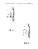 Personal transportable X-ray fluorescence visualizing, imaging, or information providing diagram and image