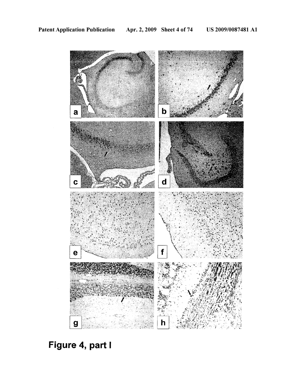 METHODS OF TREATING NEUROLOGICAL CONDITIONS WITH HEMATOPOEITIC GROWTH FACTORS - diagram, schematic, and image 05