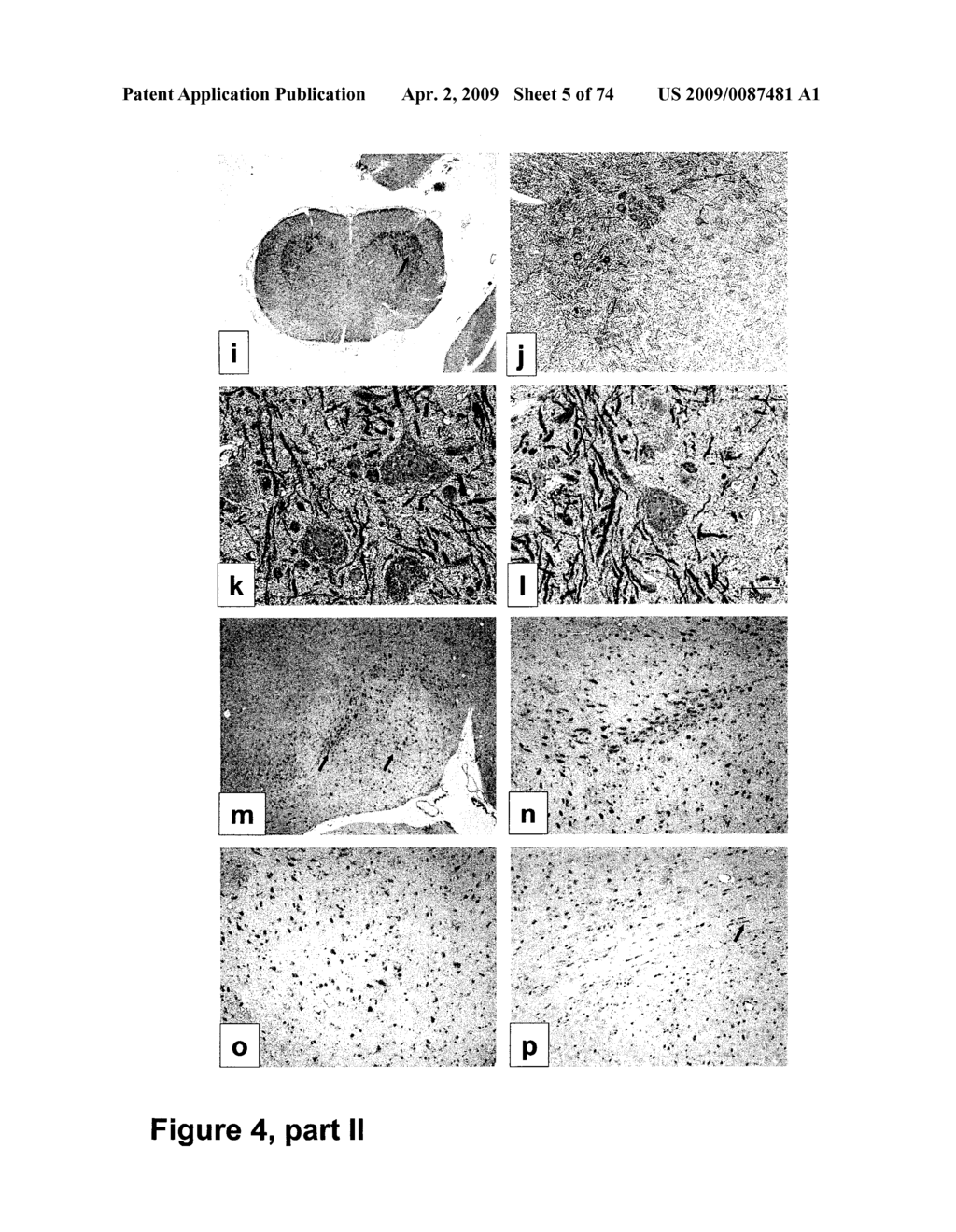 METHODS OF TREATING NEUROLOGICAL CONDITIONS WITH HEMATOPOEITIC GROWTH FACTORS - diagram, schematic, and image 06