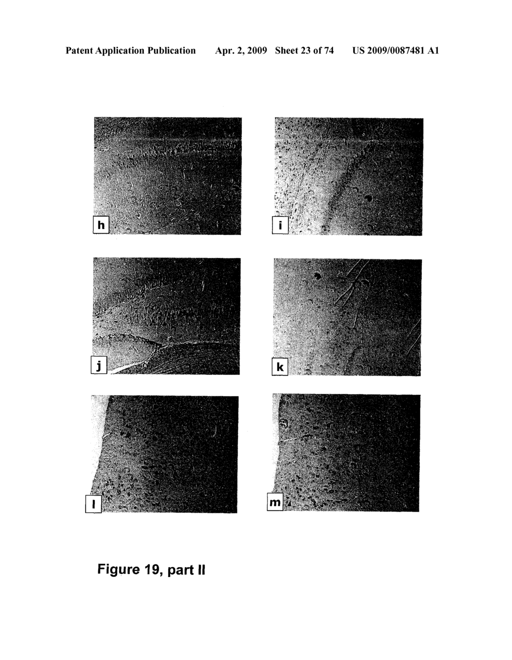 METHODS OF TREATING NEUROLOGICAL CONDITIONS WITH HEMATOPOEITIC GROWTH FACTORS - diagram, schematic, and image 24