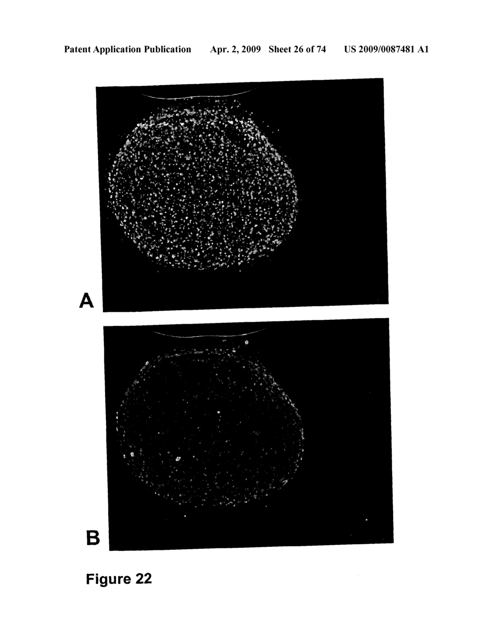 METHODS OF TREATING NEUROLOGICAL CONDITIONS WITH HEMATOPOEITIC GROWTH FACTORS - diagram, schematic, and image 27