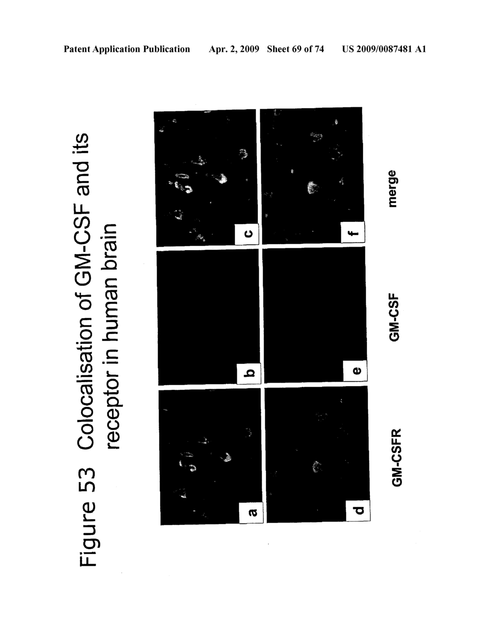 METHODS OF TREATING NEUROLOGICAL CONDITIONS WITH HEMATOPOEITIC GROWTH FACTORS - diagram, schematic, and image 70