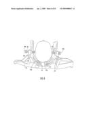 MRI-COMPATIBLE HEAD FIXATION FRAME WITH COOPERATING HEAD COIL APPARATUS diagram and image