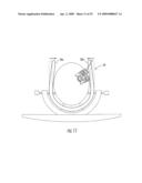 MRI-COMPATIBLE HEAD FIXATION FRAME WITH COOPERATING HEAD COIL APPARATUS diagram and image