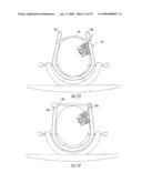 MRI-COMPATIBLE HEAD FIXATION FRAME WITH COOPERATING HEAD COIL APPARATUS diagram and image