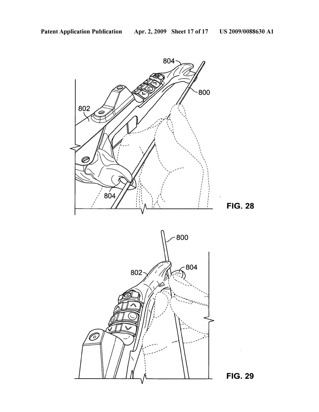 Surgical navigation tracker, system and method - diagram, schematic, and image 18