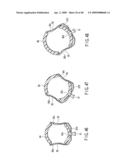 SURGICAL OPERATING APPARATUS diagram and image