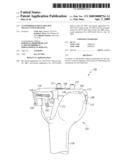 Customized Patient-Specific Multi-Cutting Blocks diagram and image