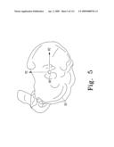 Customized Patient-Specific Multi-Cutting Blocks diagram and image