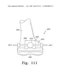 Customized Patient-Specific Multi-Cutting Blocks diagram and image