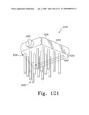 Customized Patient-Specific Multi-Cutting Blocks diagram and image