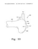 Customized Patient-Specific Multi-Cutting Blocks diagram and image