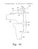 Customized Patient-Specific Multi-Cutting Blocks diagram and image