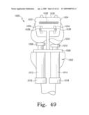 Customized Patient-Specific Multi-Cutting Blocks diagram and image