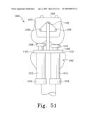 Customized Patient-Specific Multi-Cutting Blocks diagram and image